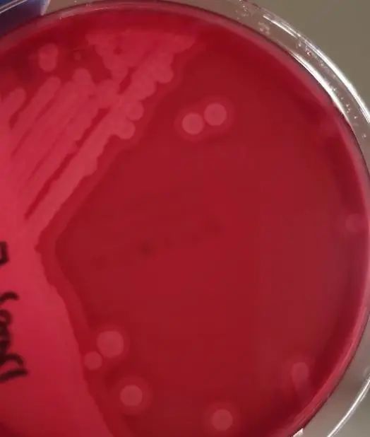 产气荚膜梭菌血平板图片