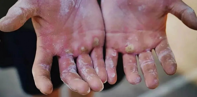 这就是中国军人的手!_腾讯新闻