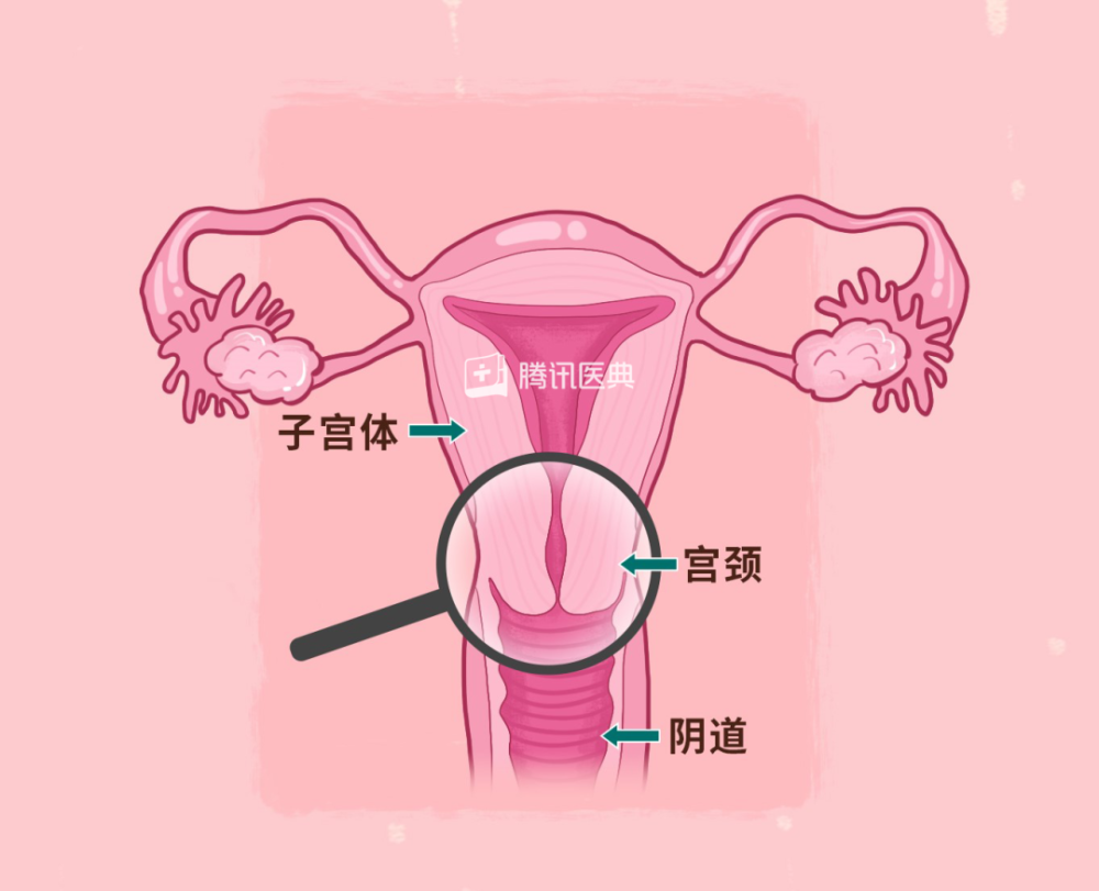 宫颈炎会变成宫颈糜烂吗这3种情况不用治