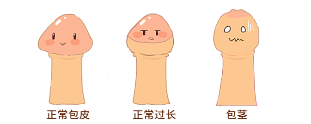 如何判断孩子包皮过长?要割吗?-腾讯新闻