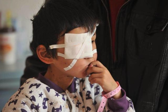 七岁男孩眼睛被人残忍抠瞎