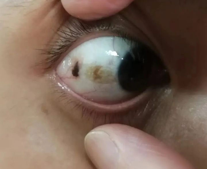 相亲时姑娘一句话男子越想越怕我的眼睛好像发霉了