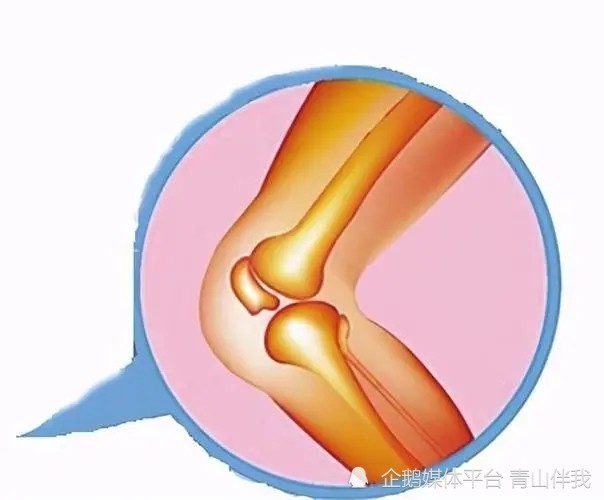 半月板損傷靜養是要絕對臥床嗎