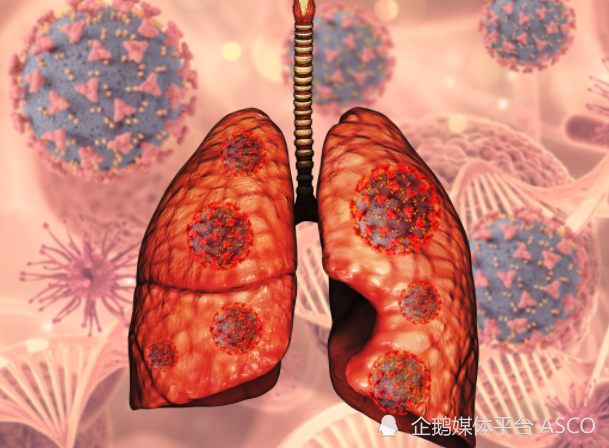 FDA tremelimumab durvalumab NSCLC 