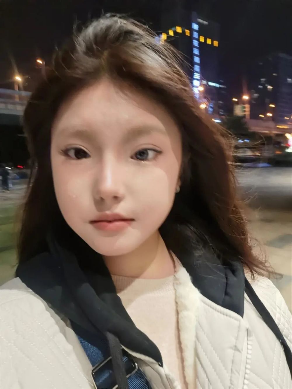 18岁女孩天生异瞳!曾被称为"怪物",现在美成这样_腾讯新闻