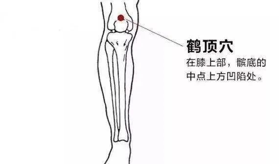 艾灸鹤顶穴可以有效缓解膝痛,腿痛,鹤膝风,膝关节酸痛,腿足无力,下肢