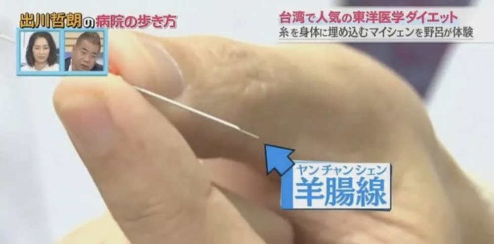 手術減肥_減肥手術有什么危害_減肥手術哪種效果好