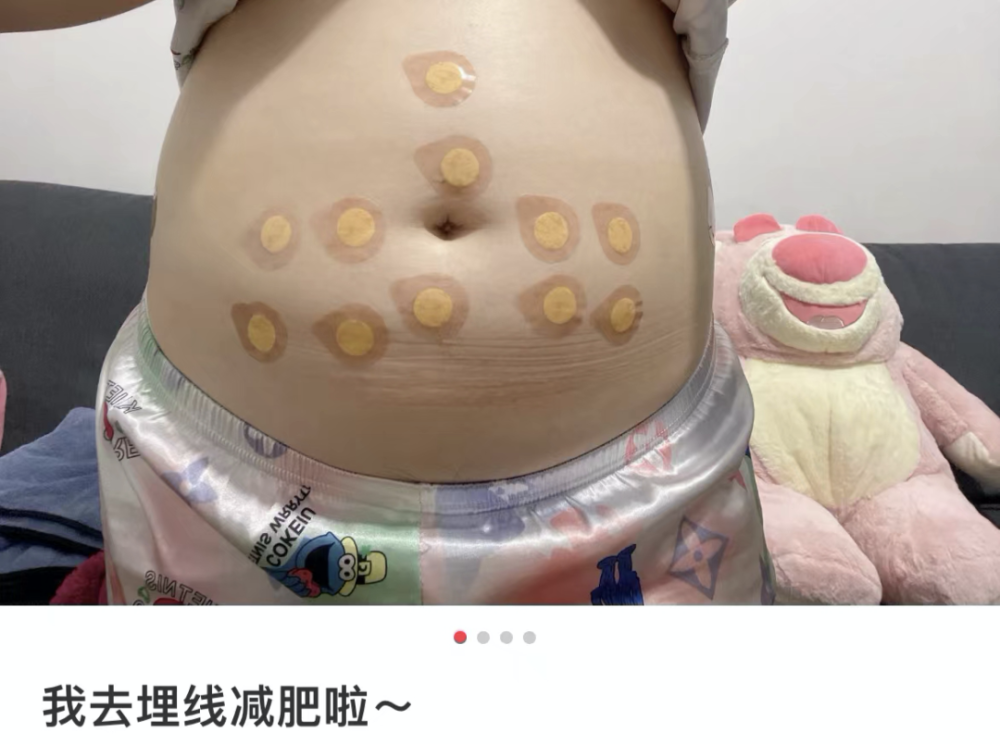 減肥手術哪種效果好_手術減肥_減肥手術有什么危害