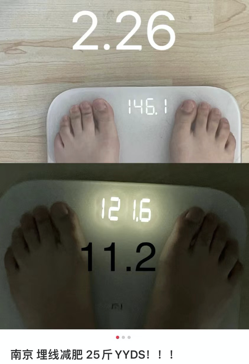 減肥手術哪種效果好_減肥手術有什么危害_手術減肥