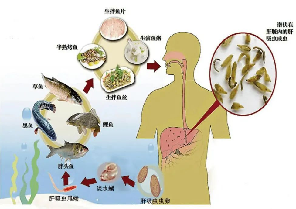 生腌鱼虾,当心暗藏肝吸虫_腾讯新闻