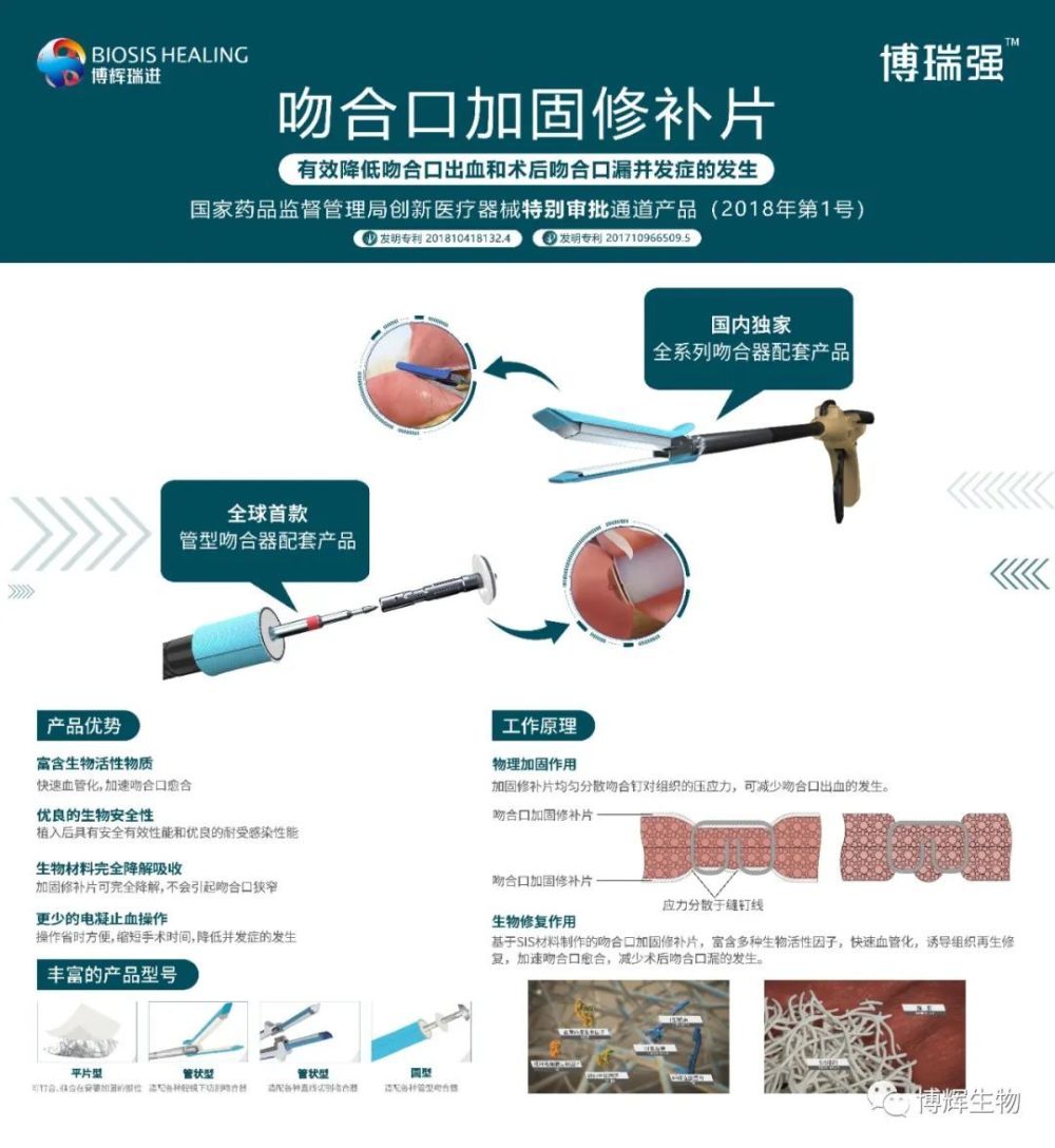 第六届全国机器人与腹腔镜外科学术会议召开博辉瑞进产品惊艳亮相