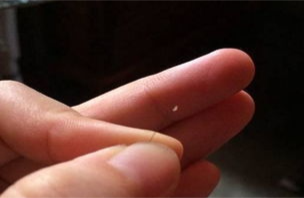 就很奇怪~有时候头皮痒,还会扣下来一根头发带着像油脂粒一样的东西