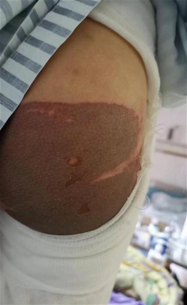 男子带强酸致男童灼伤,加强地铁安检需落到实处