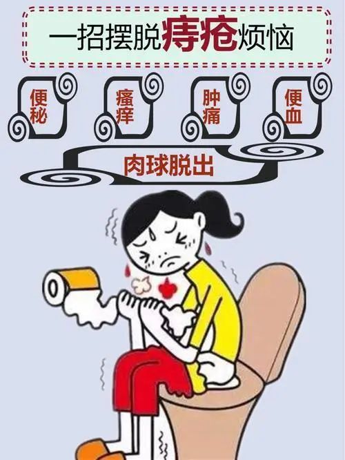 女性外痔瘡是長什麼樣?自我療法 這幾個方法一定要看