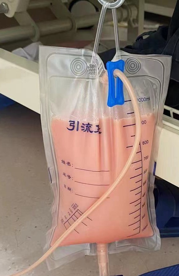 这可能是引起他呕吐,嗜睡的原因,入院后进行胸腔穿刺引流,一次性引流