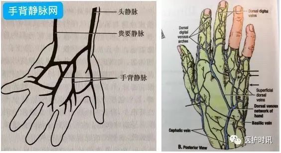 手背静脉网:手背静脉网是上肢浅静脉的一部分,位于皮下,与深静脉之间