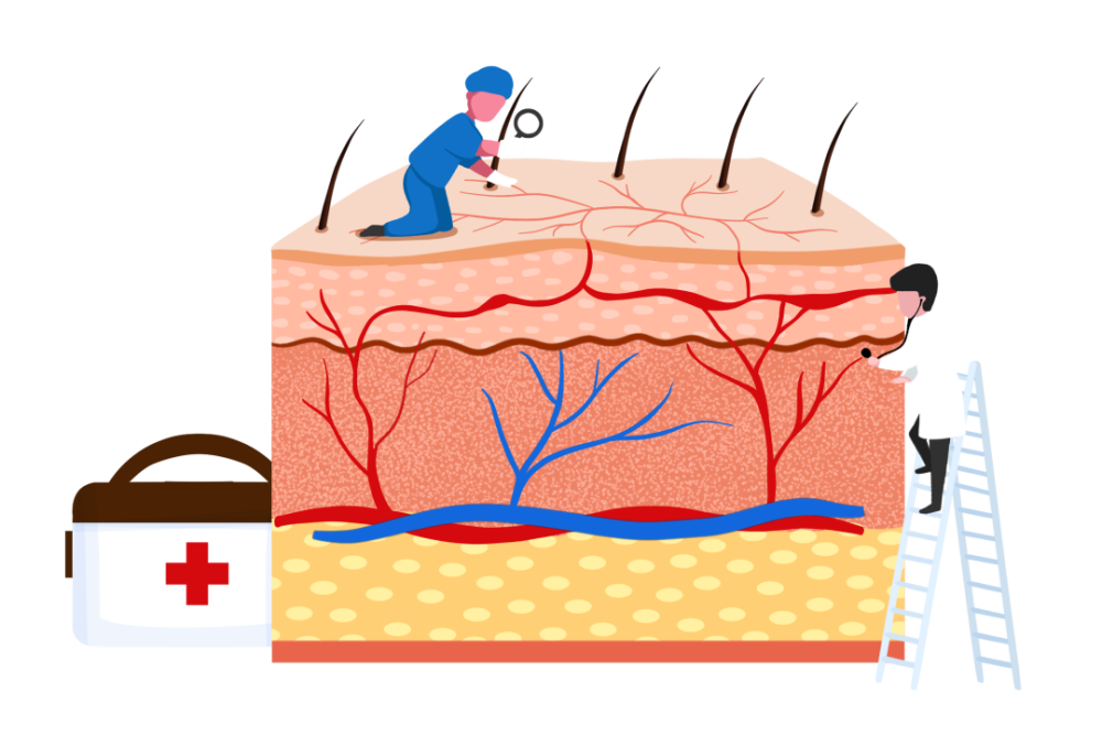 代谢紊乱,微循环调节机制受损,结构和功能亦受损,导致皮肤微循环障碍