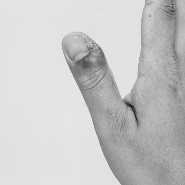 饭前烫碗饭后刷牙勤剪指甲这些看似卫生的好习惯你可能一直都做错了