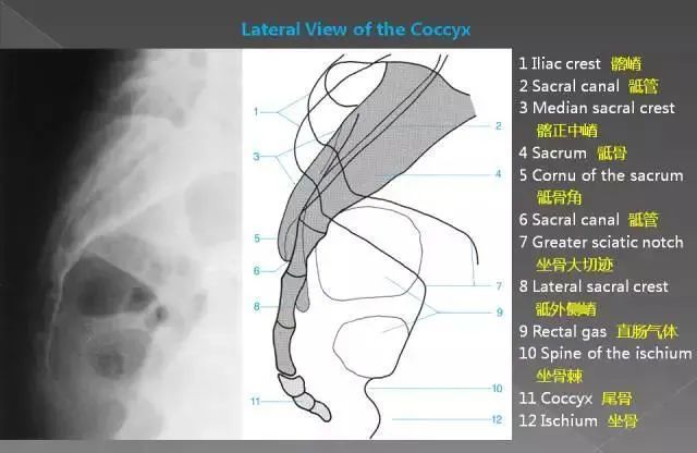x线入门|详细的腰椎x线解剖 解读