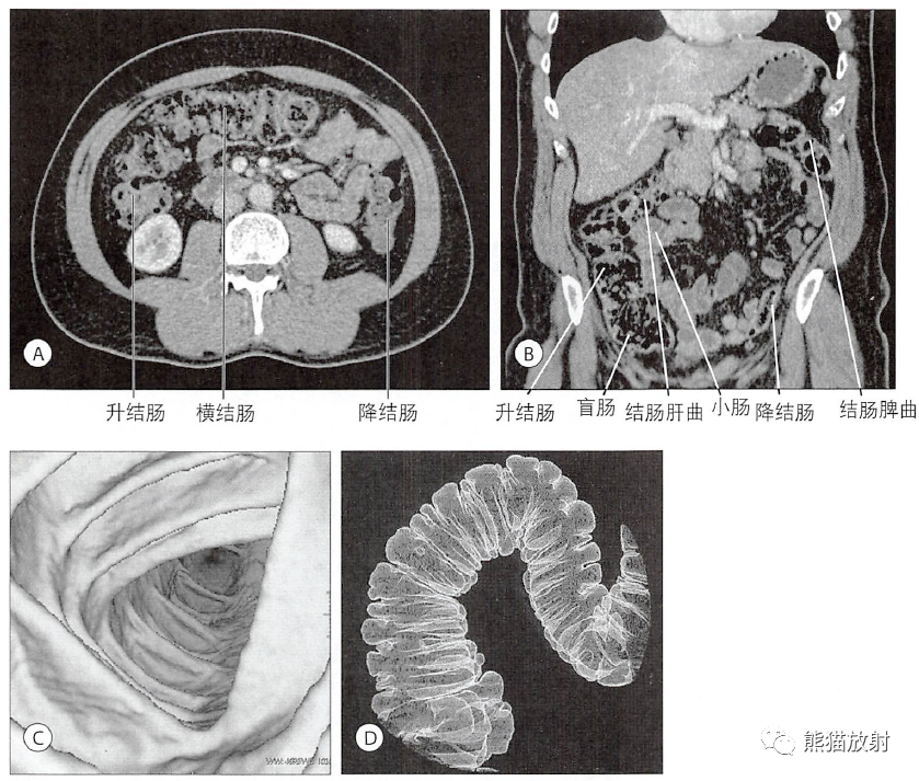 結腸壁的層次結腸鋇灌腸結腸的外觀及其毗鄰小腸絨毛的架構空腸和迴腸