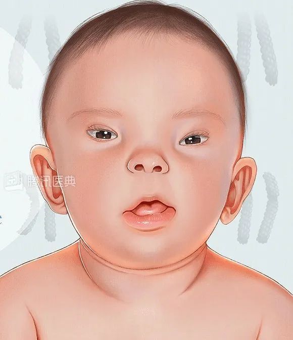 实话说,这只猫的长相和唐氏儿的长相还挺像的:很多人说这只小猫咪肯定