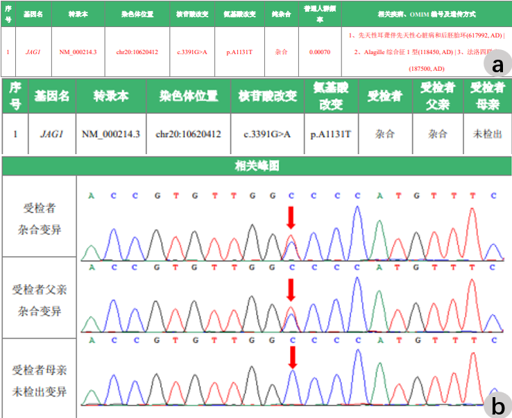 管中窥病，见微知著：1例肝功能异常、胆汁淤积查因的罕见成人病例