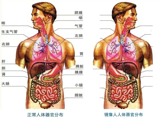 陈阿姨是一名发生率约为百万分之一的心肝脾胃肠等内脏位置180度反位