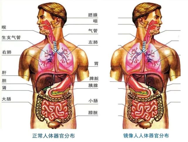 内脏反位图片