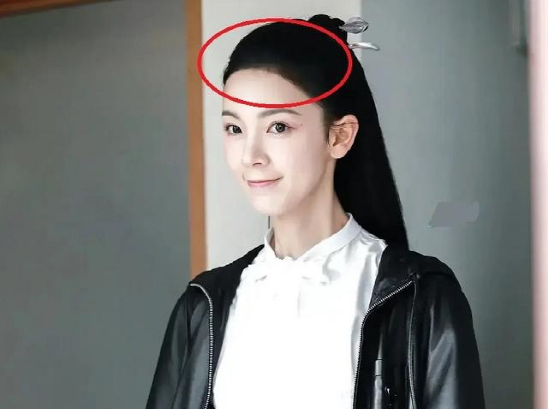 从头秃到茂盛，14位明星逆天改命增发量，用了什么“科技与狠活”？_腾讯新闻