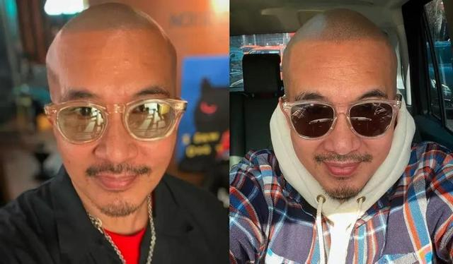 生发液,假发片,植发,纹发,明星在头发上的"小心机"简直花样百出,甚至