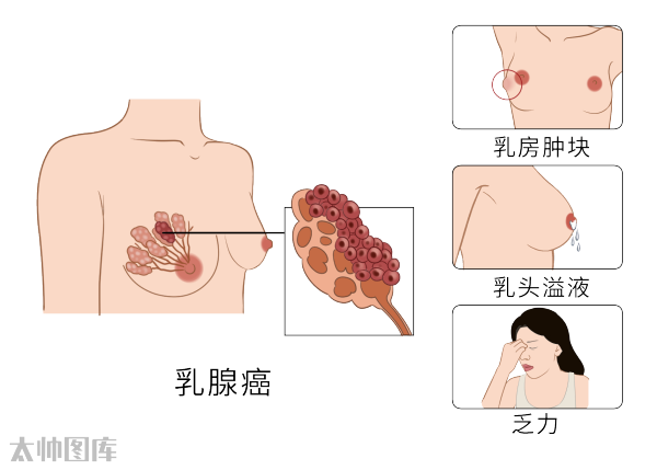 19种癌的早期信号和筛查建议 早知道能救命 腾讯新闻