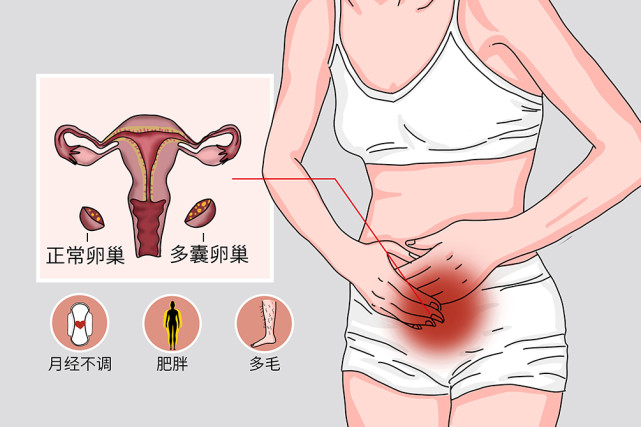 子宫内膜增厚,哪类女性最容易发生?