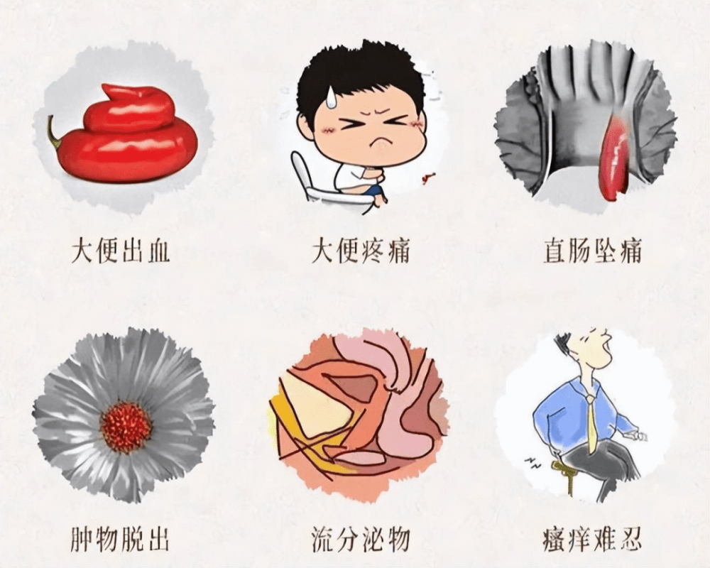 痔疮怎么引起的啊 腾讯网