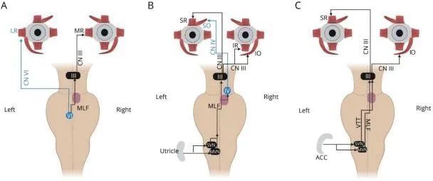 前半规管前庭眼反射(vor)通路.
