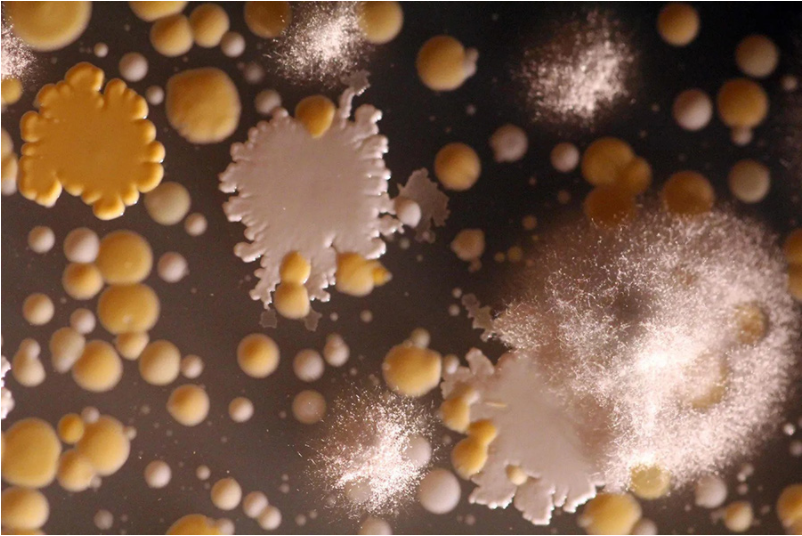 美味奶酪的背后靠谁？一文探秘奶酪中的微生物王国_腾讯新闻