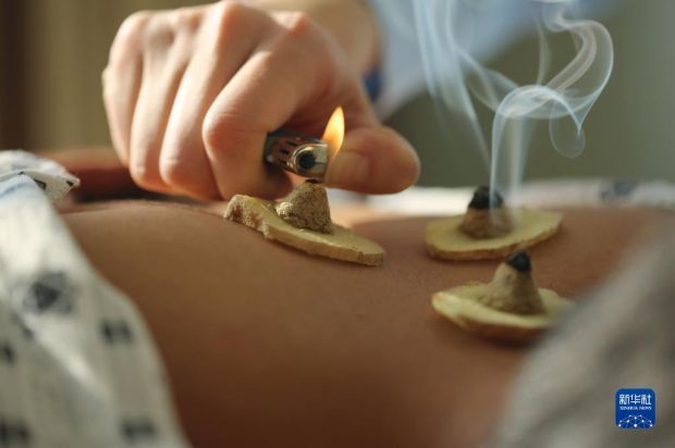 12月19日,山东省临沂市沂南县中医医院,医务人员为市民做隔姜灸.