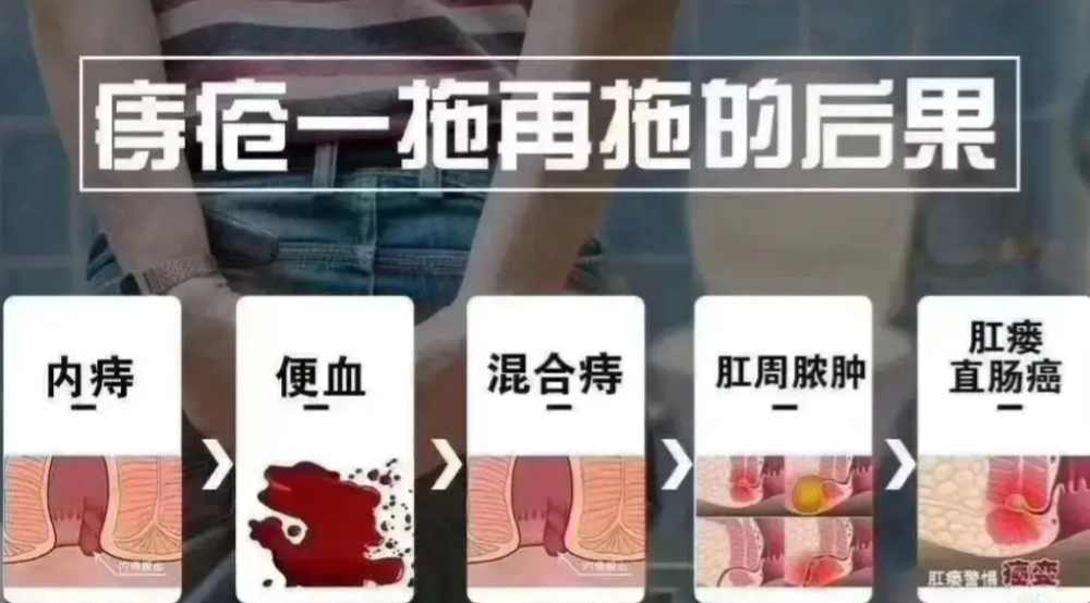 痔疮长什么样子你懂吗