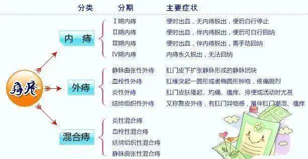 痔疮自查怎么判断自己是否得了痔疮痔疮用什么药最有效