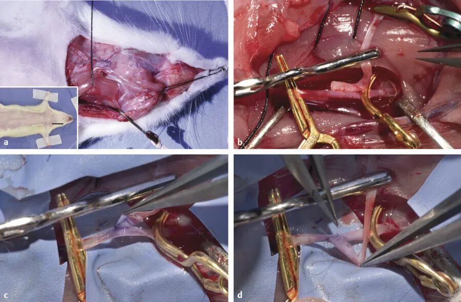 thieme|大鼠颈动脉端侧吻合-by pass训练2_腾讯新闻