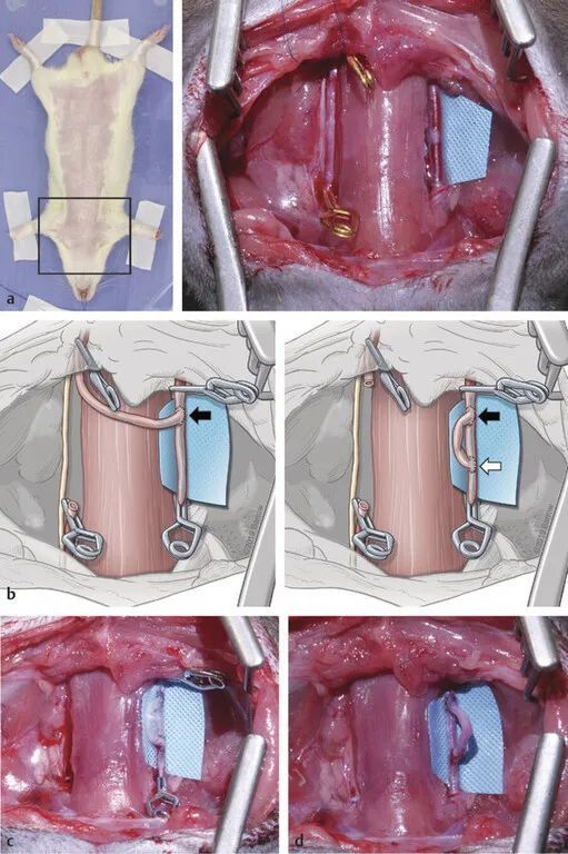 thieme|大鼠颈动脉端侧吻合-by pass训练2_腾讯新闻