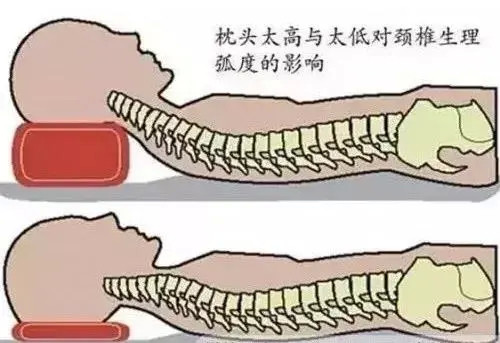 1,睡觉姿势很重要预防颈椎病真的很重要而在我国,颈椎病的发病率约为