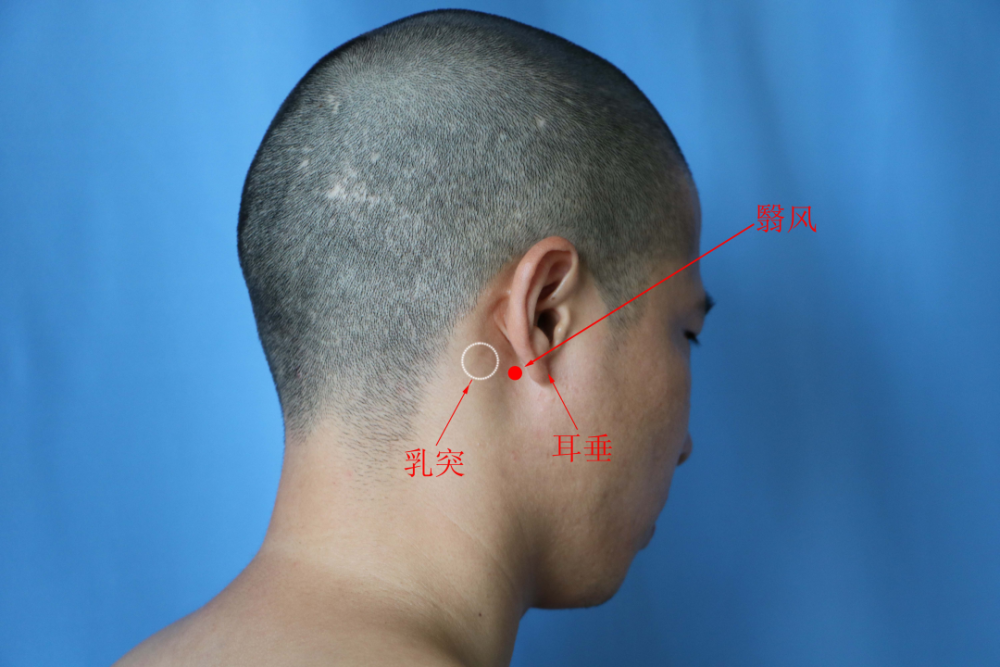 中医针灸来帮您_腾讯新闻