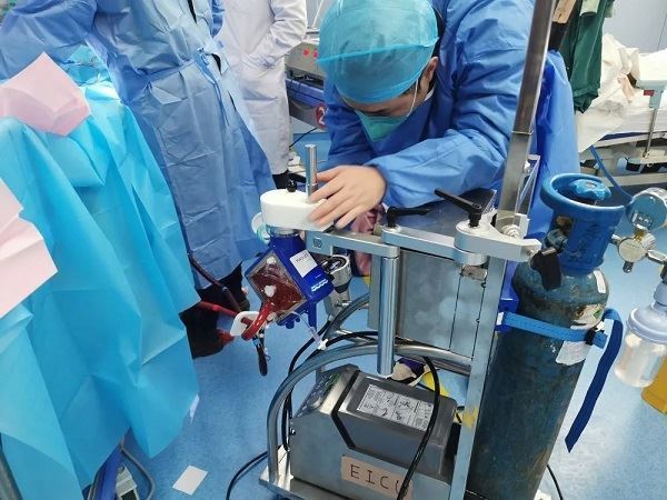 黔南州中医医院ICU：使用ECMO技术成功完成重症患者院际转运_腾讯新闻