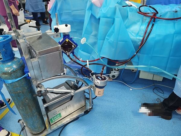 黔南州中医医院ICU：使用ECMO技术成功完成重症患者院际转运_腾讯新闻