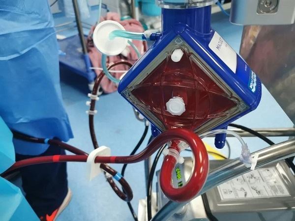 黔南州中医医院icu:使用ecmo技术成功完成重症患者院际转运