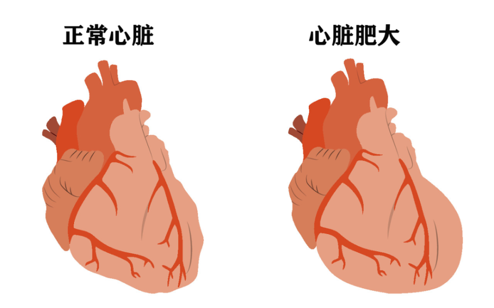 心脏变大 腾讯网