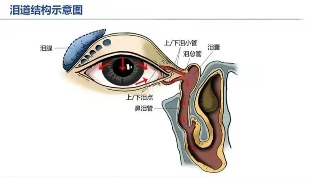 合肥爱尔眼科科普:有关于泪道疾病那些事_腾讯新闻
