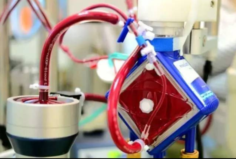 我国国产体外膜肺氧合治疗ecmo产品应急获批上市