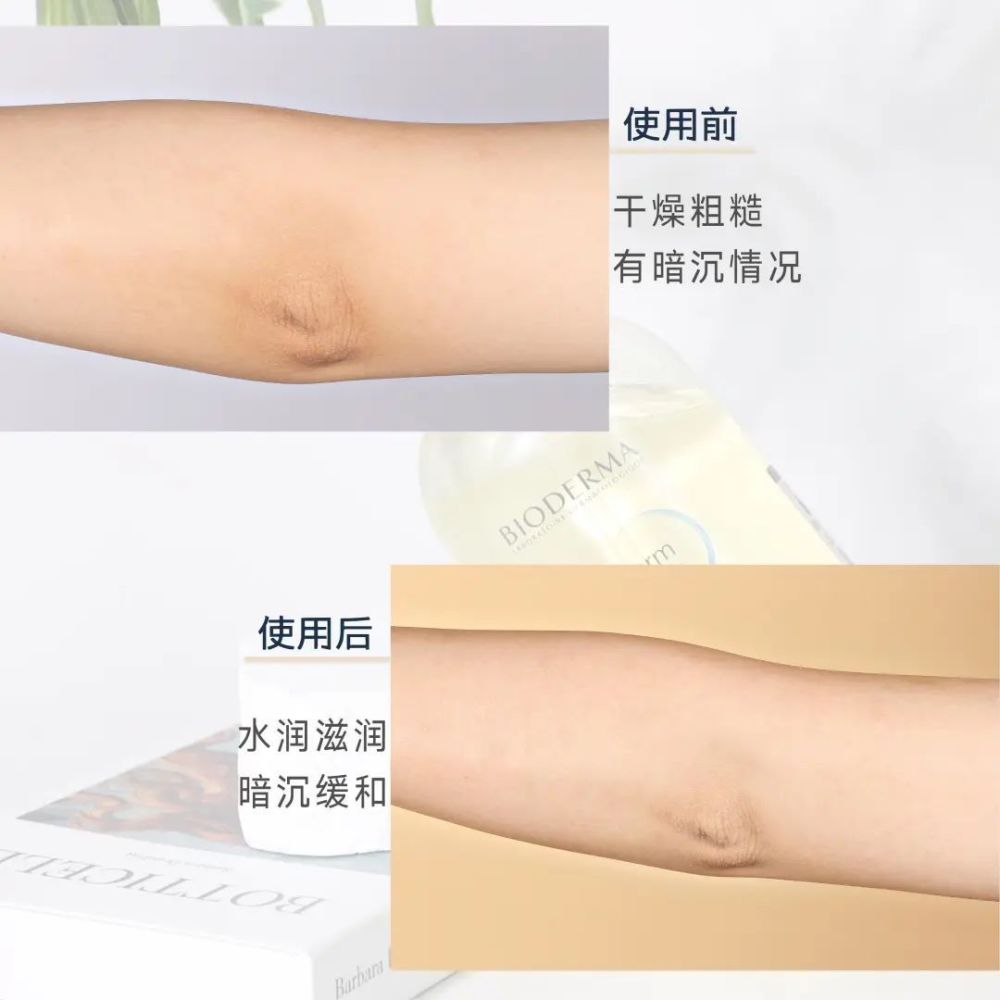 鸡皮肤图片素材库(鸡皮肤有几种类型高清图片)