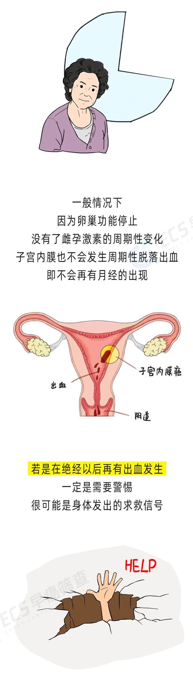 癌症月经图 宫颈癌图片